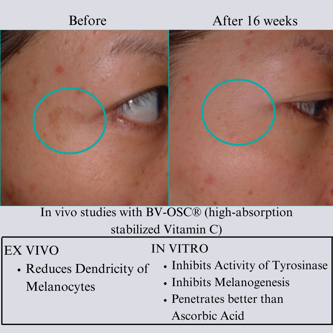 Hyaluron 3D Hydrator Multi Lamellar Emulsion The Advanced Response Face and Neck Cream-Serum