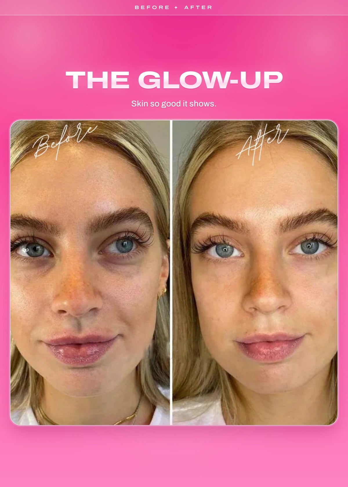 It Girl Skin – Skin Food